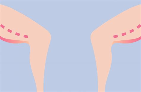 Thigh Lift Surgery 101: Everything You Need To Know